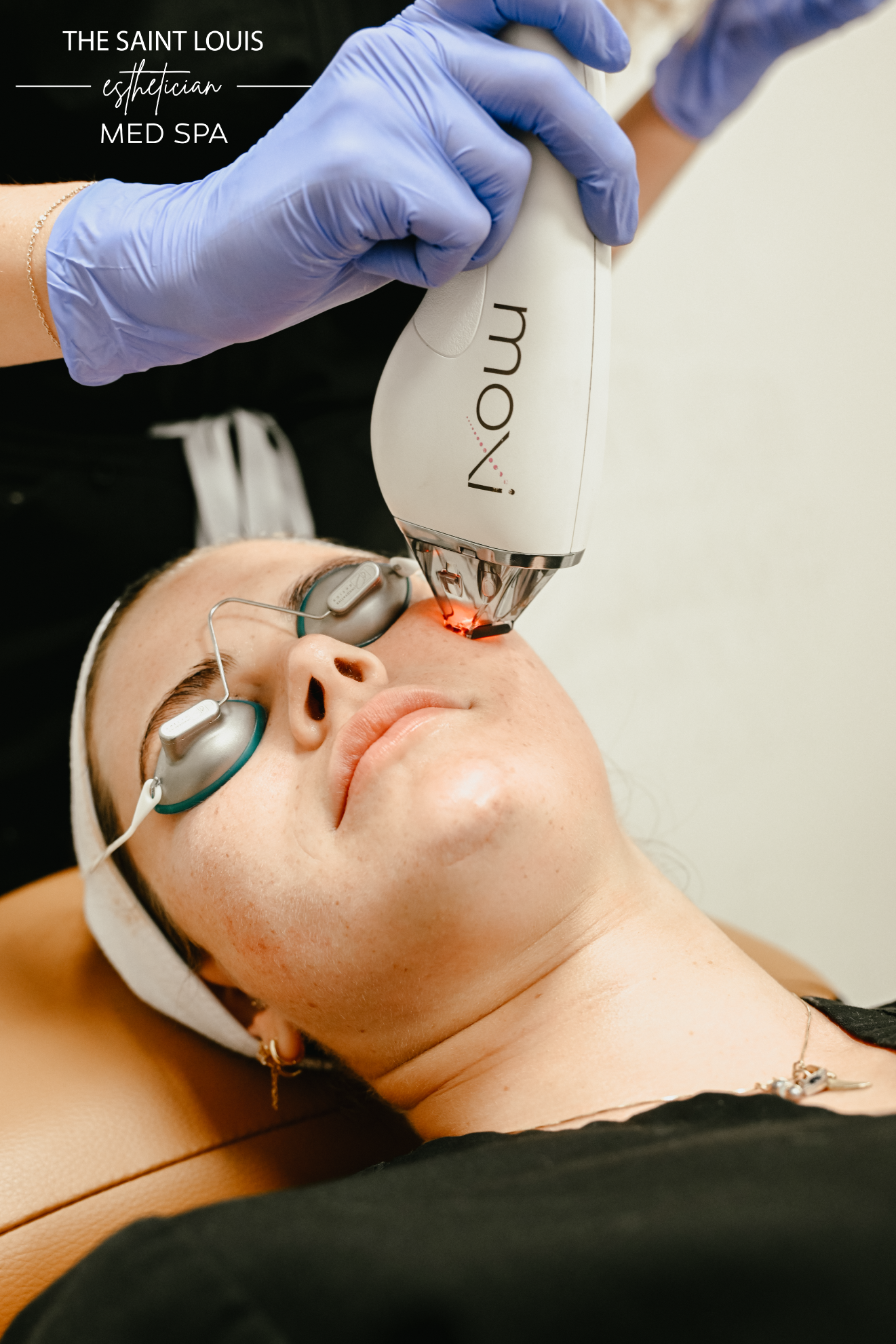 Black Friday Special - Moxi x 3 Treatments