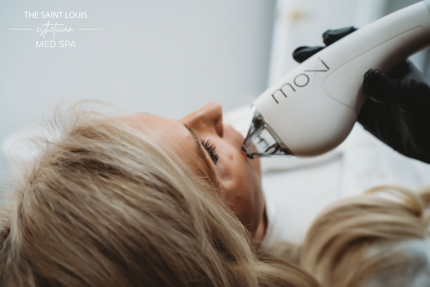 Moxi + BBL Laser Face Treatment - 1 Session