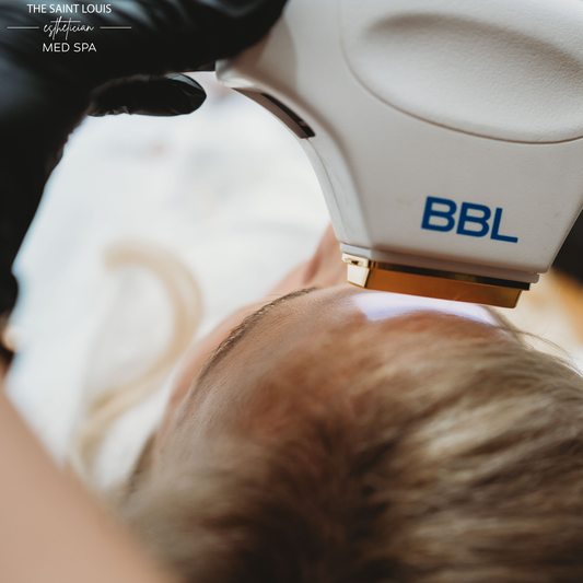 2026 Open House Special - Broadband Laser (BBL)
