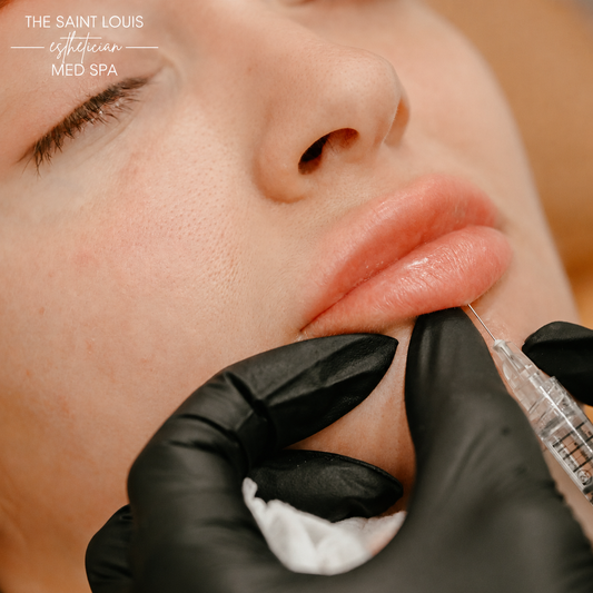 2026 Open House Special - Lip Filler (One Syringe) for $599