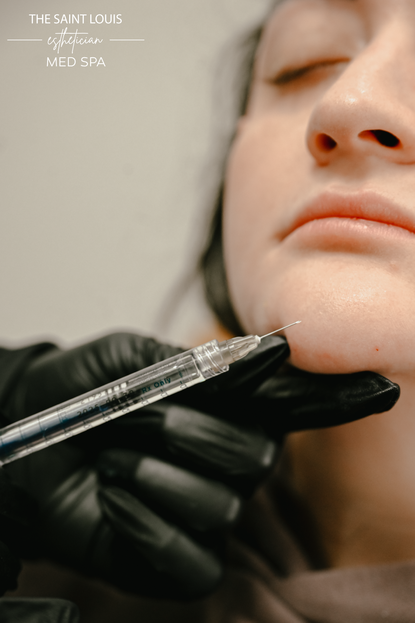 Chin Filler Dermal Filler - 1 Syringe