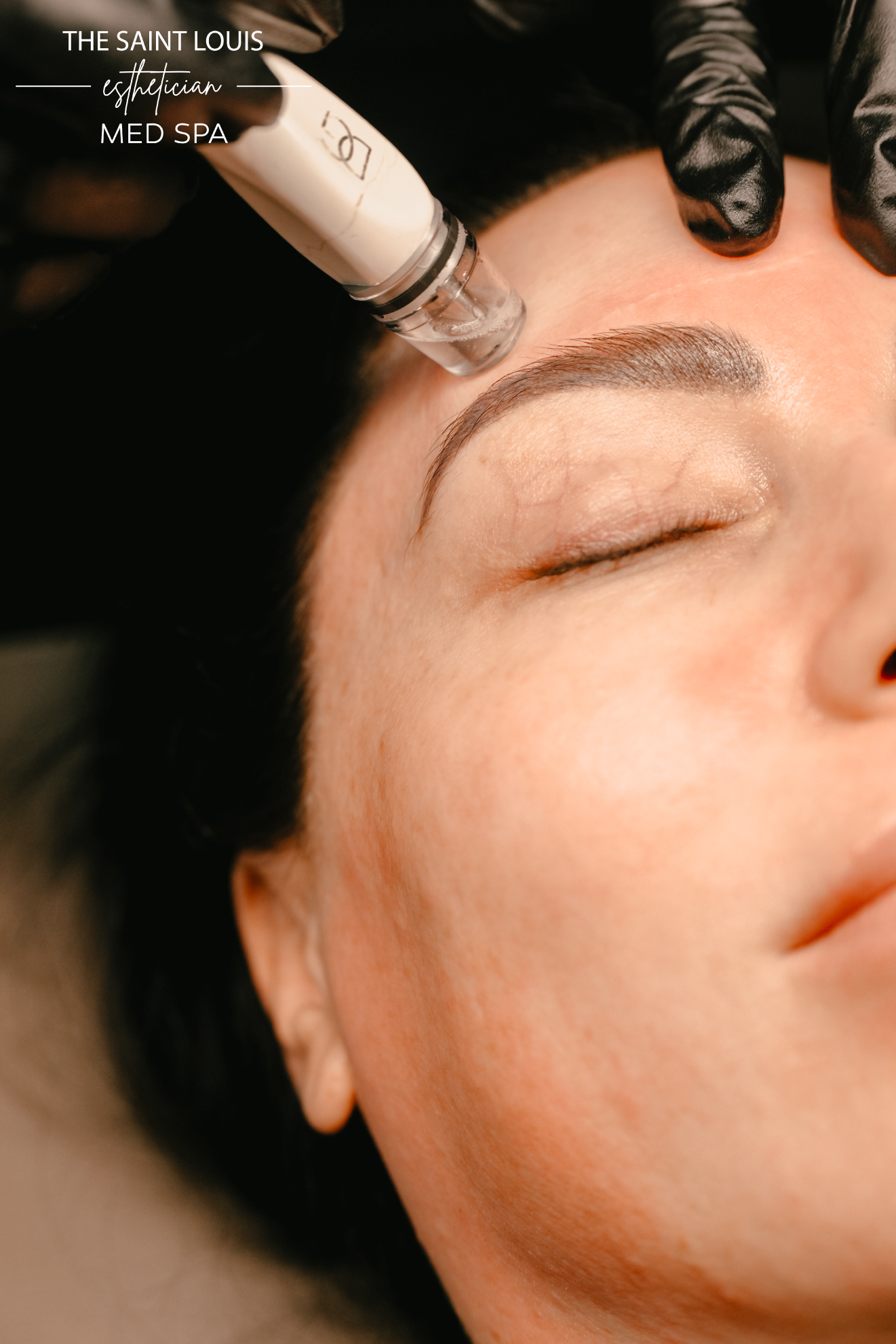 Diamond Glow with Dermaplane Facial