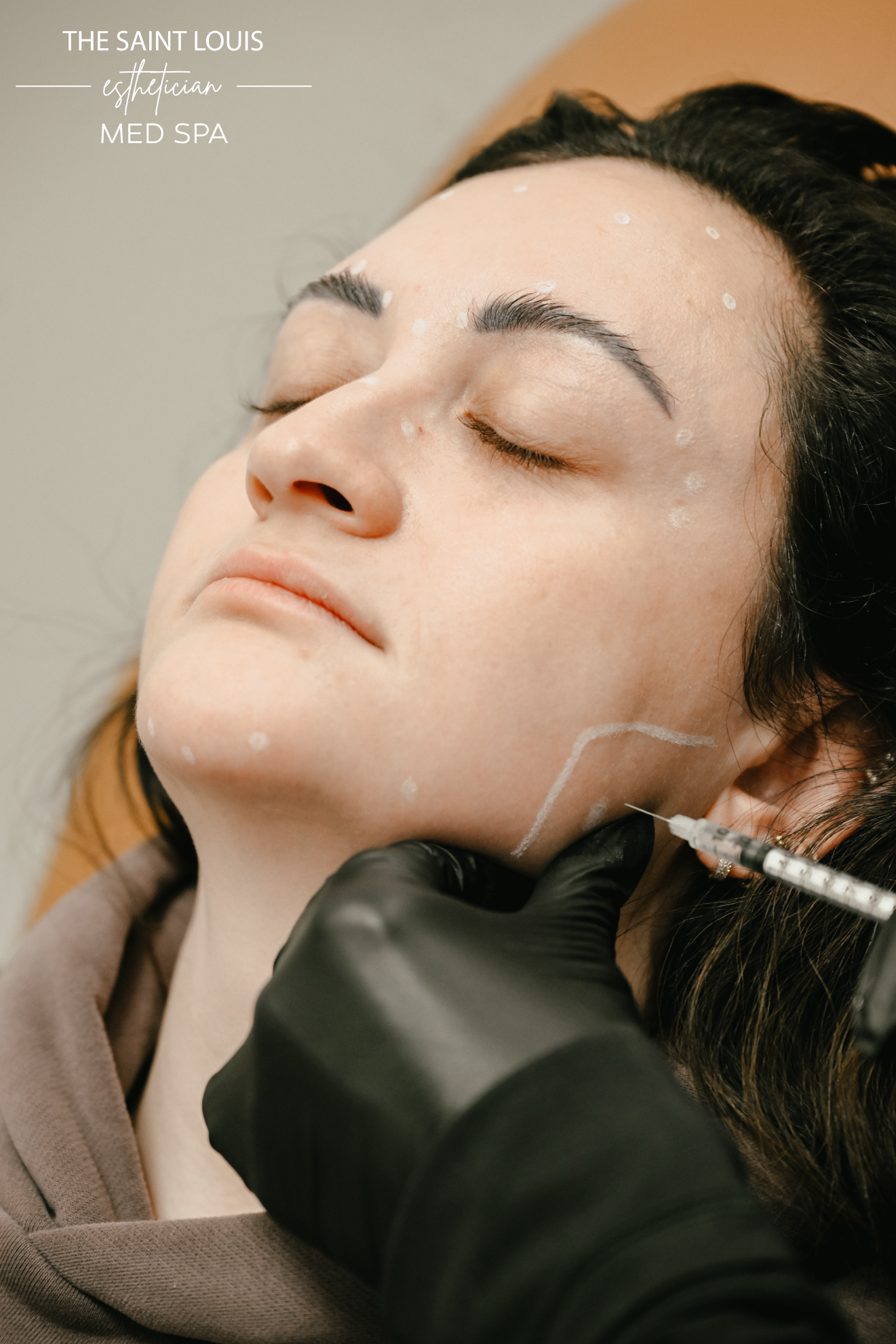 Black Friday Special - Buy Any 2 Syringes of Fillers Get One Syringe Free