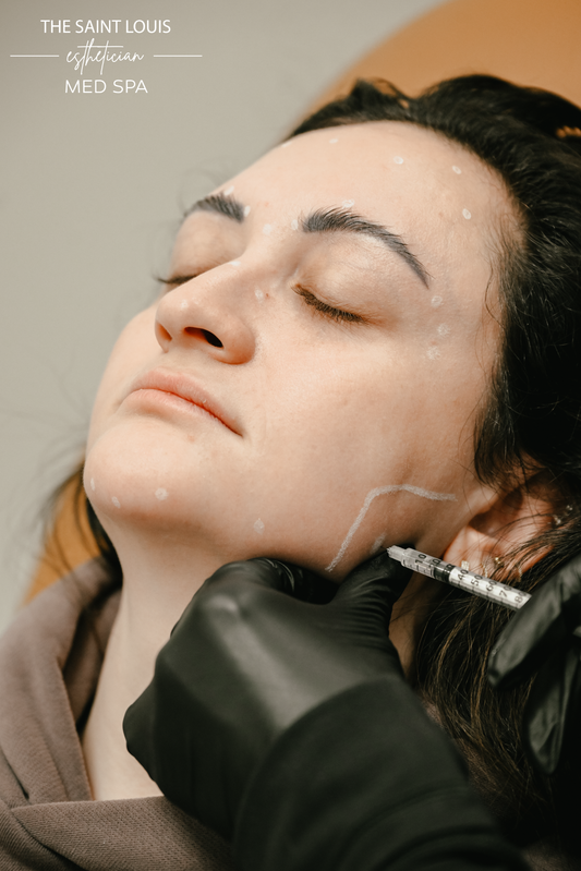 Jawline Dermal Filler - 1 Syringe