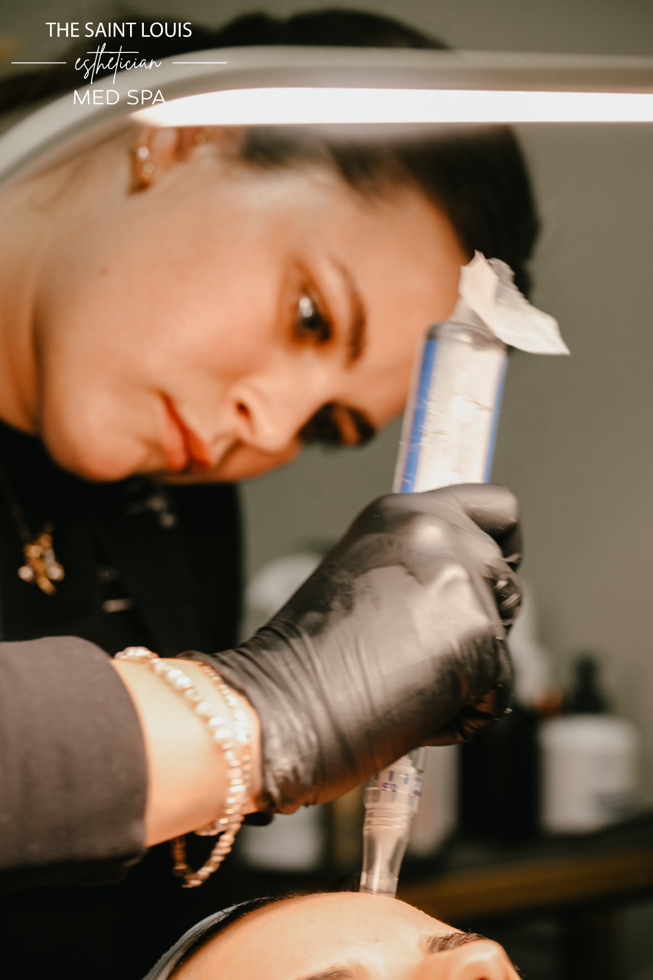 SkinPen Microneedling