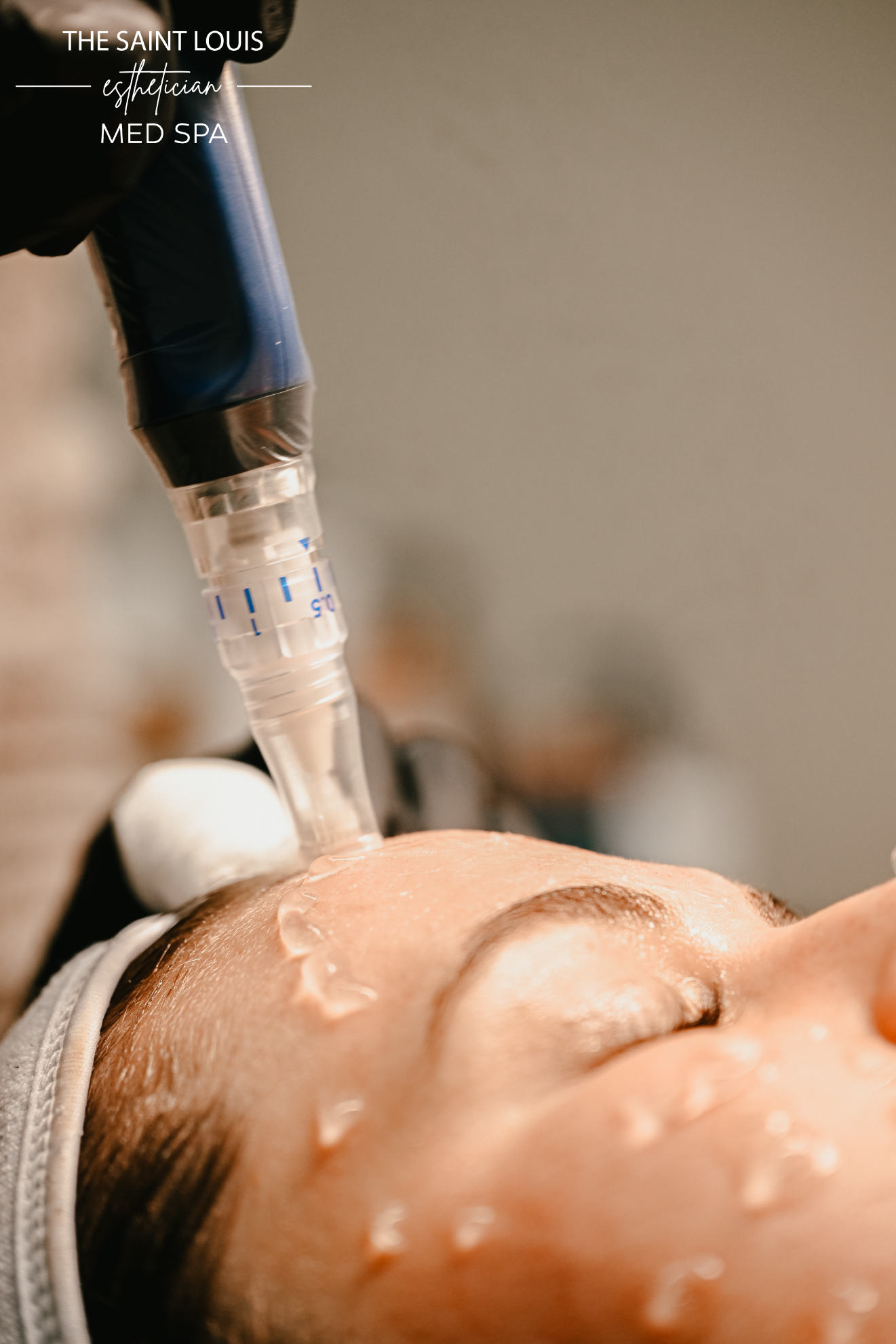 Black Friday Special - SkinPen Microneedling x 3 Sessions