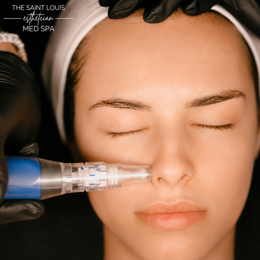 2026 Open House Special - Microneedling + Factor 5 Peel