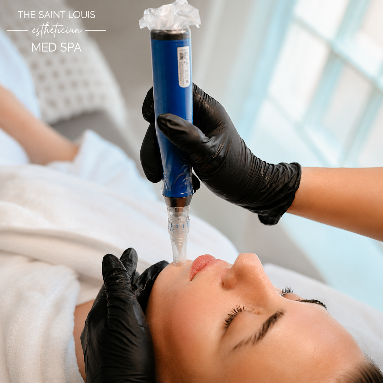 2026 Open House Special - Microneedling x 6