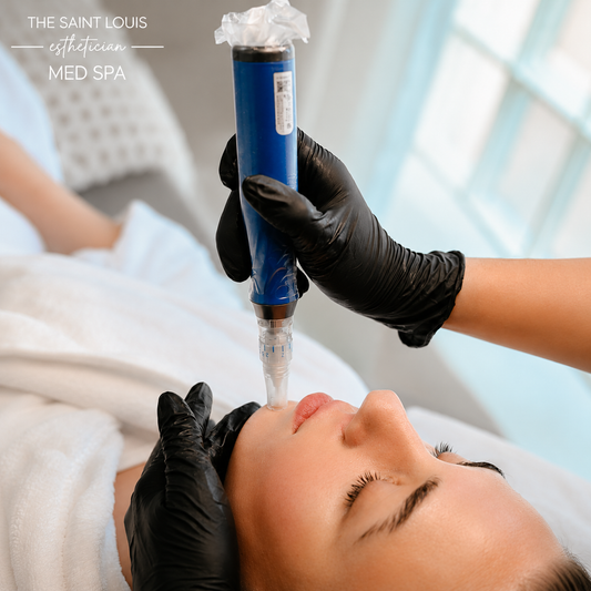 2026 Open House Special - Microneedling x 6