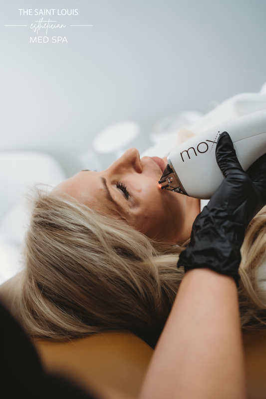 Moxi Laser Face Treatment - 1 Session