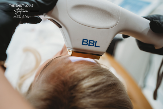 Moxi + BBL Laser Face Treatment - 1 Session