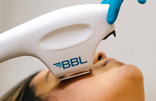 BBL Face Laser (1 session)